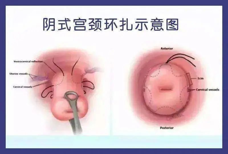 文章配圖