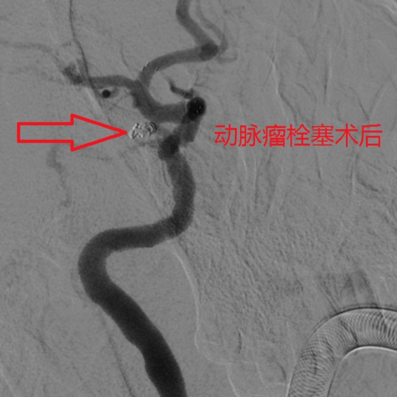 文章配圖