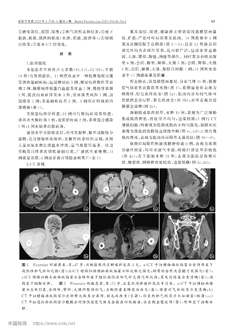 Fournier壞疽的CT表現(xiàn)和診斷_梁惠康-圖片-2.jpg