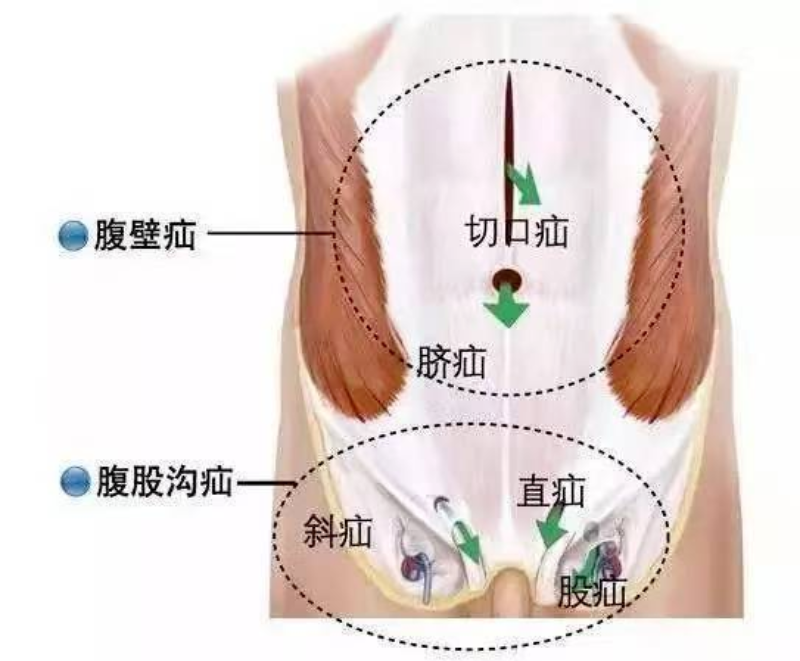 文章配圖